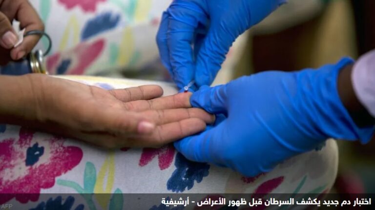 “نتائج واعدة”.. اختبار دم جديد يكشف السرطان قبل ظهور الأعراض