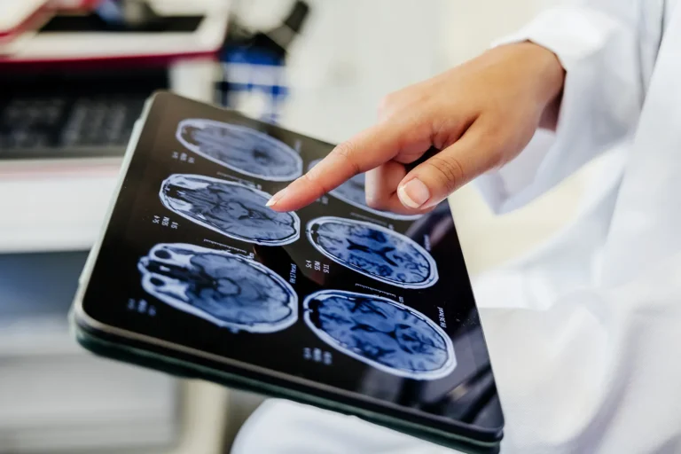 Study Finds Space Travel Alters Astronauts’ Brain Structure