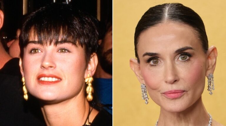 Demi Moore Sparks ‘Ozempic Ears’ Accusations At 2026 Actor Awards
